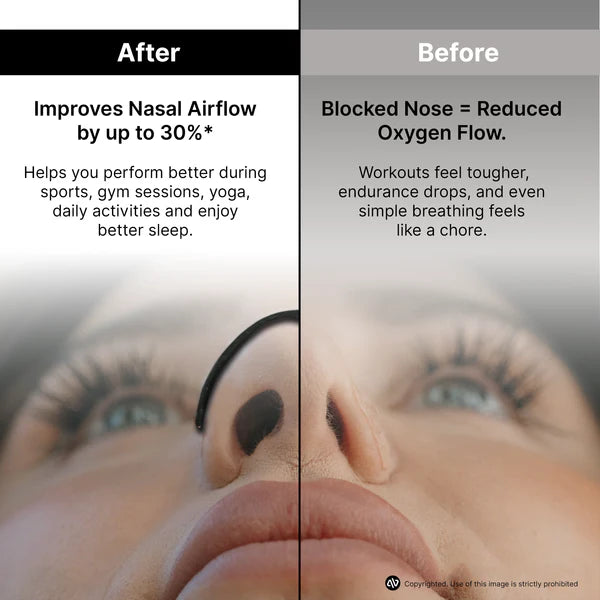 nasal strips for breathing