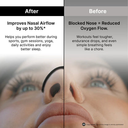 nasal strips for breathing